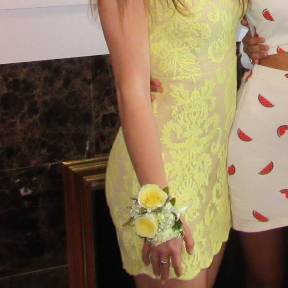 ADORABLE Yellow Lace Mini Dress